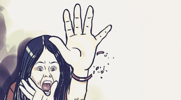 “बाेक्सी”